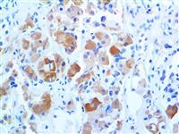 TSH (BSB-56), MMab MAIN