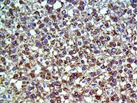 Tau (BSB-115), MMab MAIN