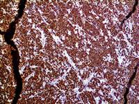 TdT (EP266), RMab MAIN