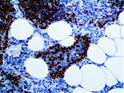 TdT (Polyclonal), RPab THUMBNAIL