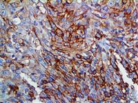 Thrombomodulin / CD141 (EP175), RMab MAIN