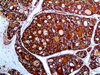 Thyroglobulin (EP250), RMab MAIN