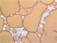 Thyroglobulin (2H11 & 6E1), MMab MAIN