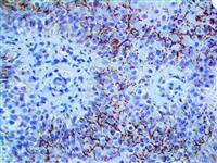 Treponema pallidum (Polyclonal), RPab MAIN