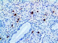 Tryptase (EP259), RMab MAIN