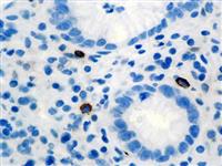 Tryptase (G3), MMab MAIN
