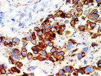 Uroplakin III (EP321), RMab MAIN