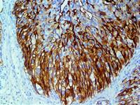 Uroplakin III (Polyclonal), RPab MAIN