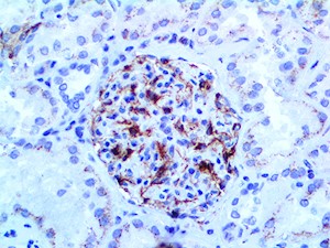 VEGFA (RBT-VEGFA), RMab MAIN