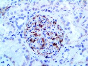 VEGFA (RBT-VEGFA), RMab THUMBNAIL