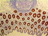 Villin (CWWB1), MMab MAIN