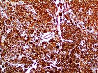 Vimentin (EP21), RMab MAIN