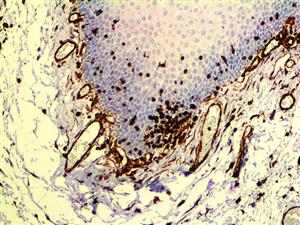 Vimentin (V9), MMab MAIN