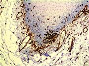 Vimentin (V9), MMab THUMBNAIL