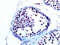 WT1 (6F-H2), MMab MAIN