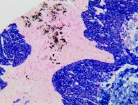 PolyDetector HRP Blue Plus Kit MAIN