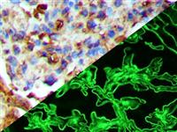 albumin anti-albumin antibody anti- immunofluorescence if immunohistochemistry ihc MAIN