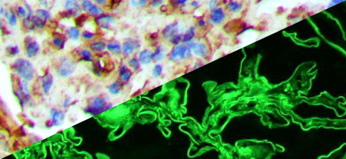Indirect Immunofluorescence Antibodies