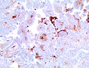 APOE, apoe4, anti-apoe4, anti apoe4, apolipoprotein E, anti-apoE, anti apoE THUMBNAIL