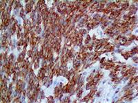 bcl-2 (BSB-5), MMab MAIN