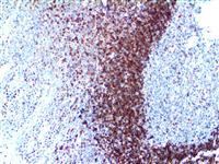 bcl-2 (EP36), RMab MAIN