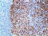 bcl-6 (RBT-bcl6), RMab MAIN