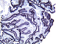 PolyDetector HRP Black MAIN