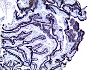 PolyDetector HRP Black THUMBNAIL