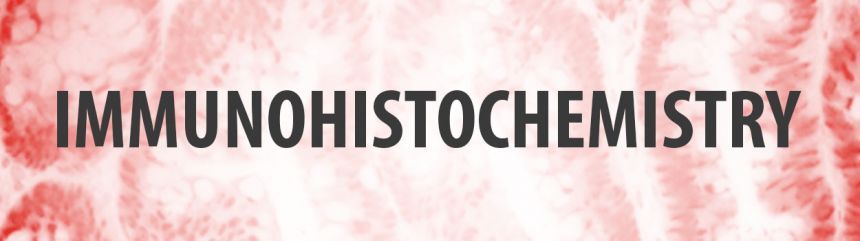 IHC, Immunohistochemistry, Pathology, Antibodies, IVD, monoclonal, polyclonal