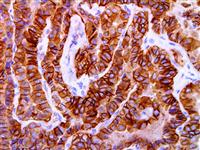c-Met / HGFR (EP1454Y), RMab MAIN
