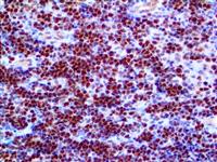 c-Myc (EP121), RMab MAIN