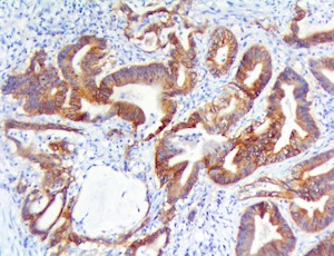 c-Met / HGFR  (RBT-c-Met/HGFR), RMab MAIN
