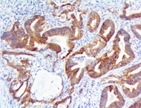 c-Met / HGFR  (RBT-c-Met/HGFR), RMab MAIN