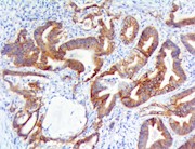 c-Met / HGFR  (RBT-c-Met/HGFR), RMab THUMBNAIL