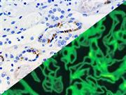 C3c (Polyclonal), RPab THUMBNAIL