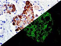 C3d (Polyclonal), RPab MAIN