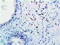 c-Myc (9 E10), MMab MAIN