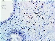 c-Myc (9 E10), MMab THUMBNAIL