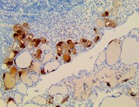 Calcitonin (RBT-Calcitonin), RMab MAIN