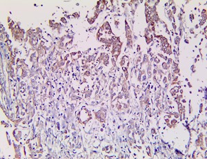 Calretinin (RBT-CALB2), RMab MAIN