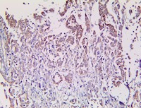 Calretinin (RBT-CALB2), RMab MAIN