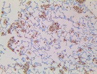 candida albicans, anti-candida albicans, anti candida, anti-albicans, anti albicans, anti-c albicans MAIN