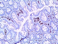 CTSK, anti-cathepsin K, anti cathepsin K, anti-CTSK, anti CTSK, cathepsin K, cathepsin X MAIN