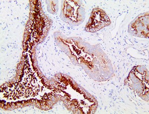 CD10 (RBT-CD10), RMab MAIN
