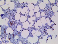 CD138 (RBT-CD138), RMab MAIN