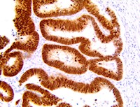 CDX2 (RBT-CDX2), RMab MAIN