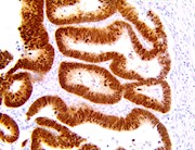 CDX2 (RBT-CDX2), RMab THUMBNAIL