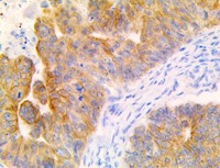 CEACAM7, anti-CEACAM7, anti CEACAM7, antibody,  carcinoembryonic antigen CGM2, CEA, CGM2 MAIN