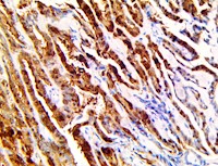 anti-cited1, anti cited1, CITED1, anti-msg1, anti msg1, melanocyte specific gene 1, melanocyte specific protein 1, MSG1 MAIN