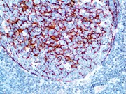 Clusterin / Apolipoprotein J (RM437), RMab THUMBNAIL